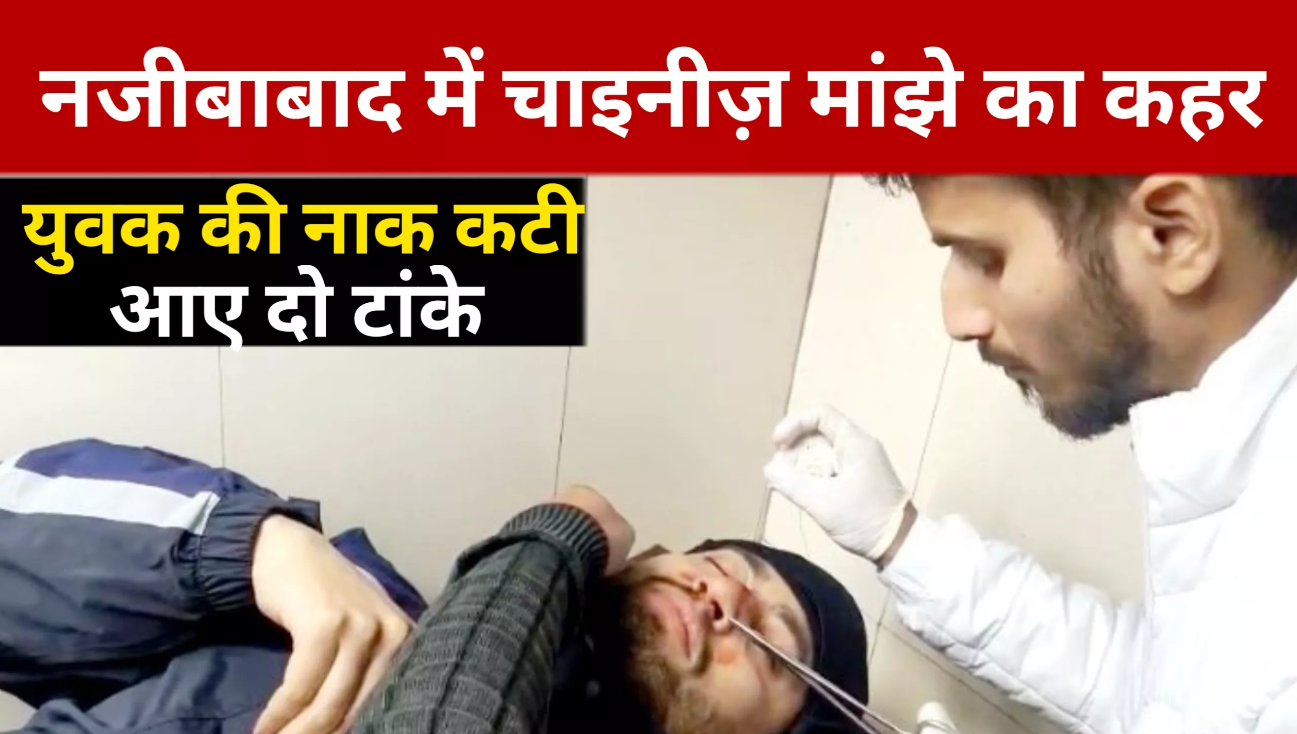 Chinese manjha wreaks havoc in Najibabad; young man's nose cut, two stitches needed